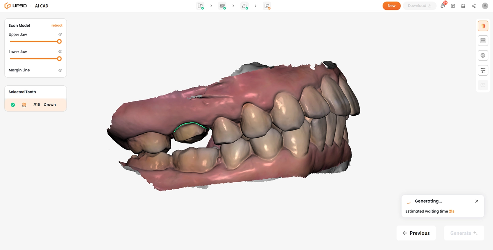 UP3D AI CAD generating dental crown restoration with AI ensuring occlusion and contact